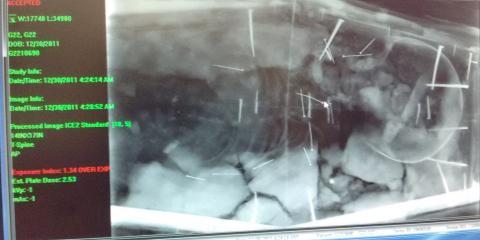 Image of the X-ray of a child coffin. Straight pins and nails are visible. Image of an X-ray on a computer screen